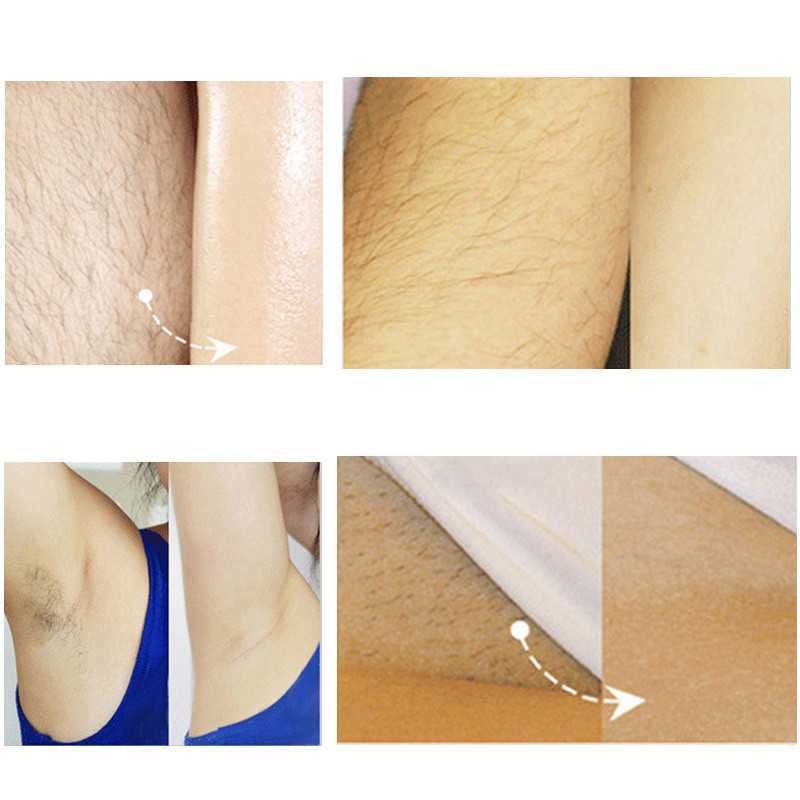 Как правильно ухаживать за кожей после процедуры