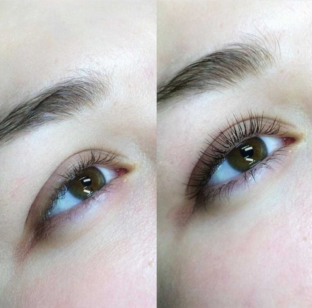 Сравнение популярных процедур восстановления ресниц