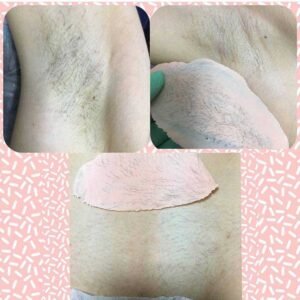 Где делают депиляцию Ташкент