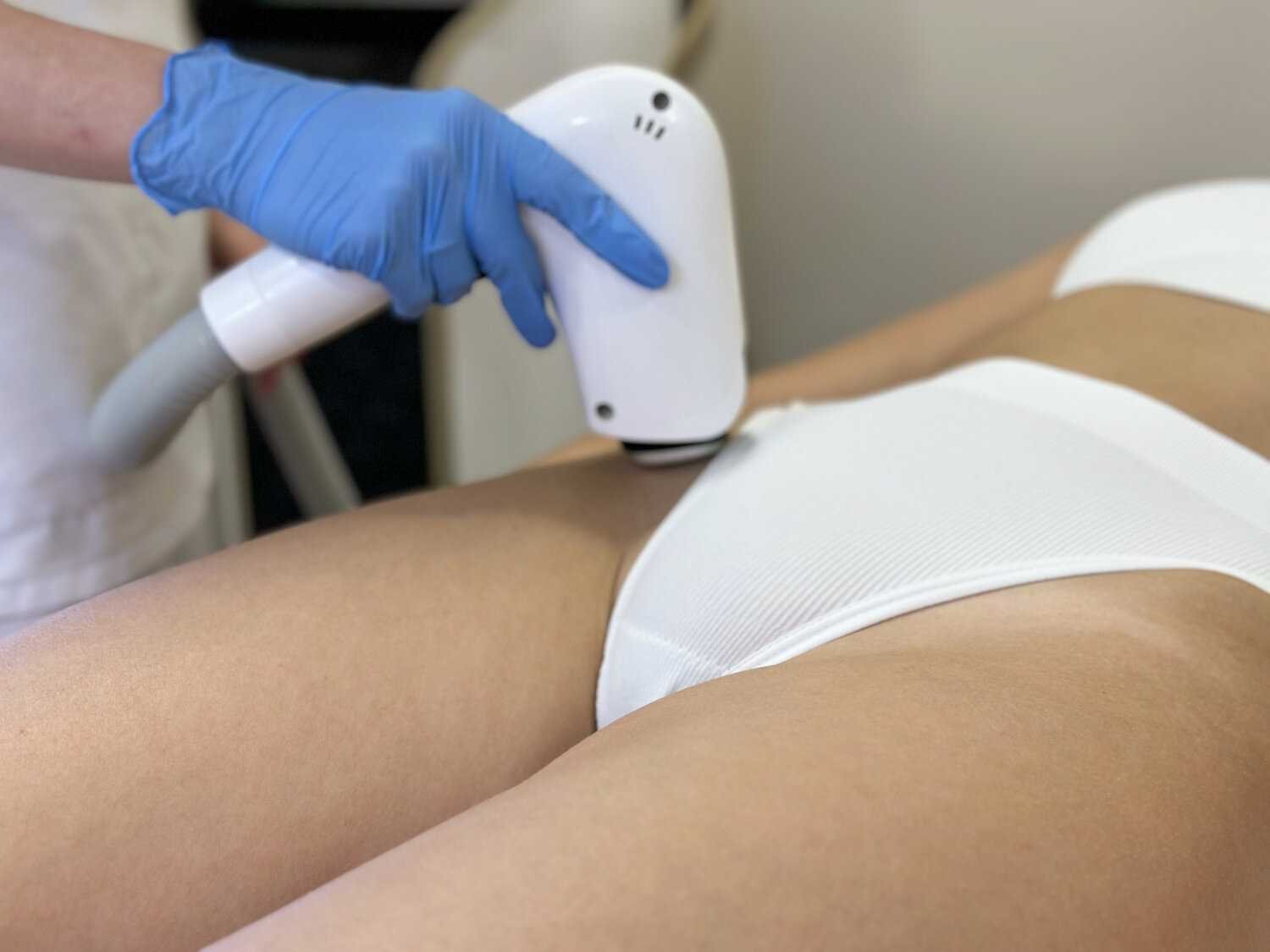 Уход за кожей после интимной эпиляции: советы и рекомендации