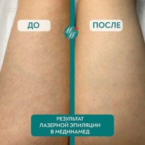 Как часто можно делать депиляцию Ташкент