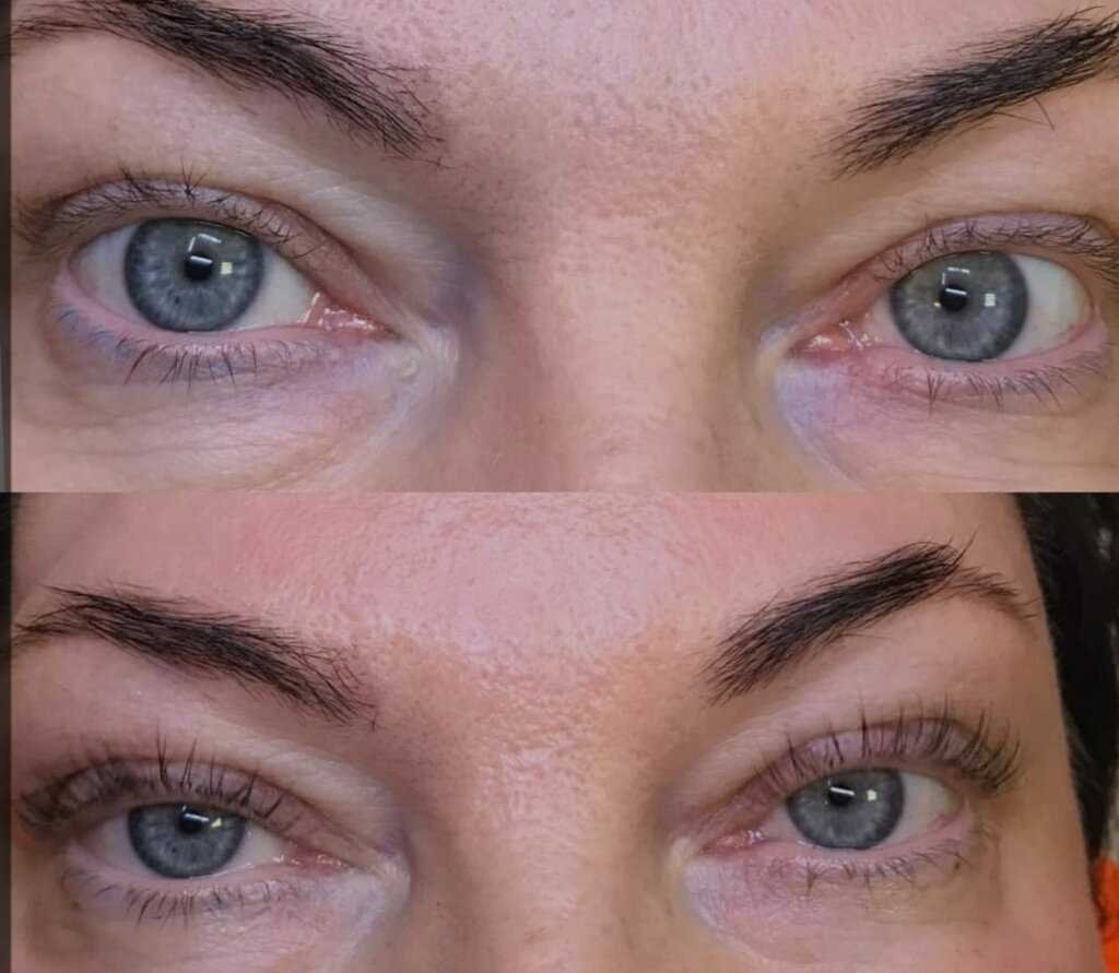 Сравнение ламинирования и других процедур для ресниц