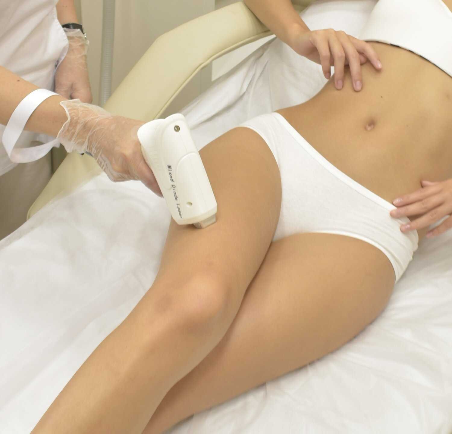 Преимущества лазерной эпиляции интимной зоны