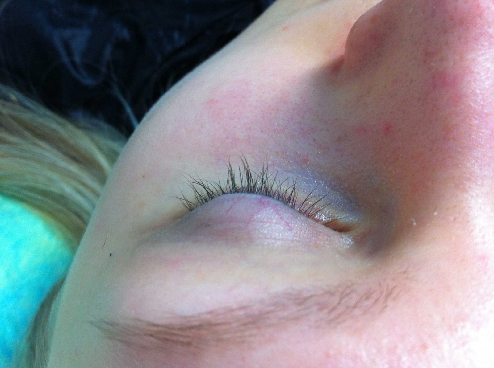 Как избежать аллергических реакций при наращивании ресниц?