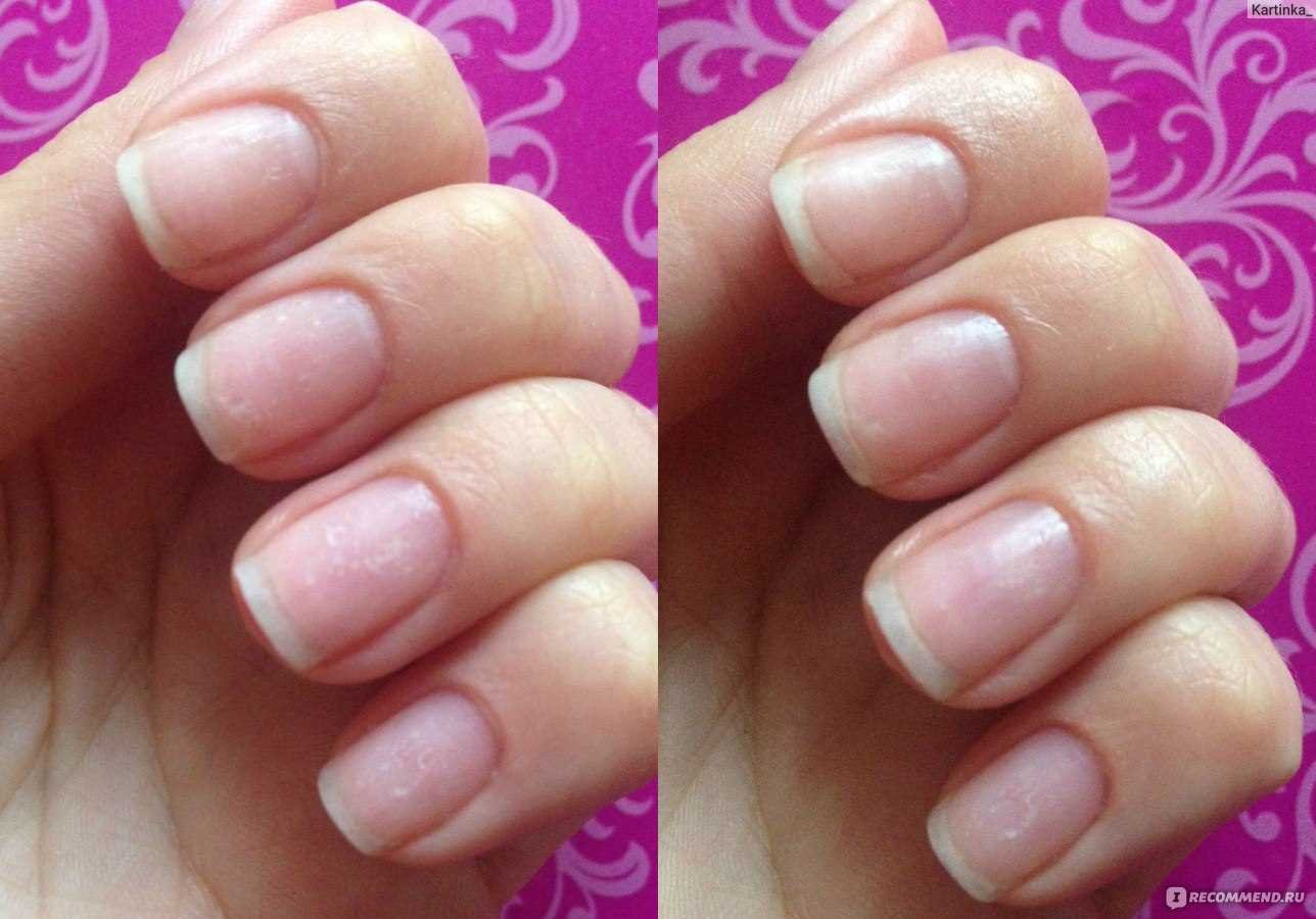 Подбор инструментария для необрезного маникюра