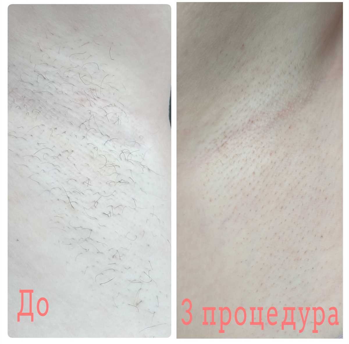 Ожидания и реальность: что рассказывают клиенты