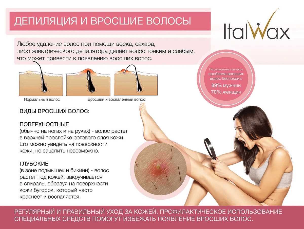 Как правильно ухаживать за кожей после депиляции