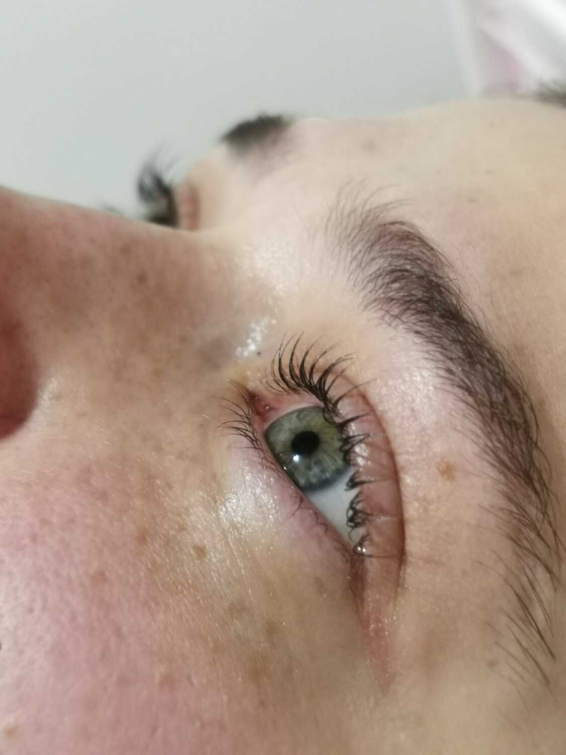 Преимущества различных технологий реконструкции ресниц