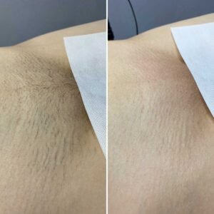 Шугаринг глубокое бикини сама себе Ташкент