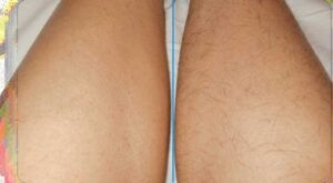 Шугаринг ног на сколько хватает Ташкент