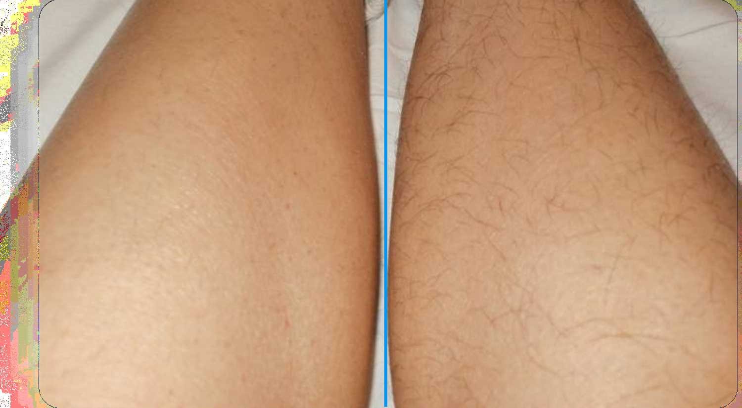 Советы по уходу за кожей после шугаринга