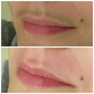 Шугаринг усиков Ташкент