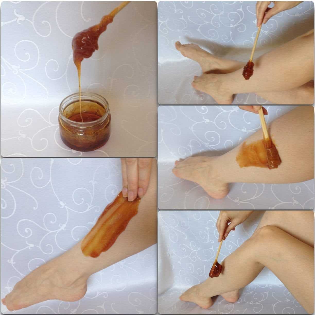 Послеэпиляционная забота о коже: что нужно знать