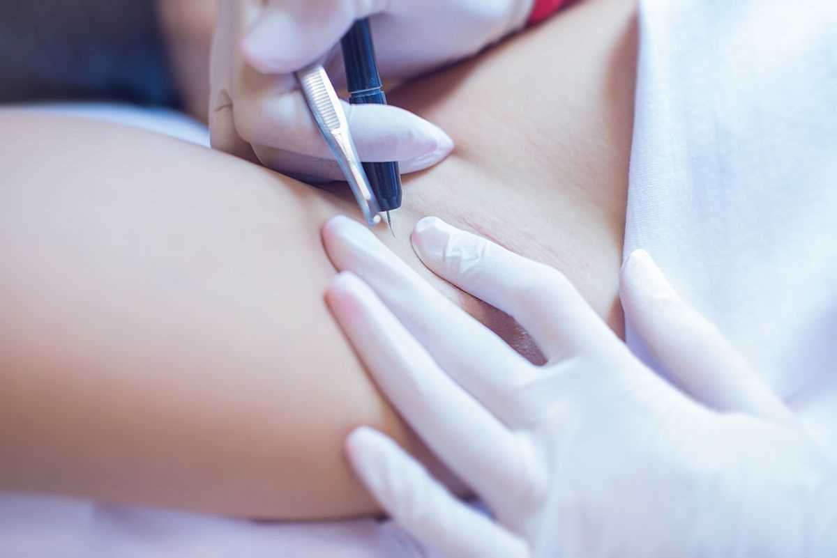 Подготовка к сеансу электроэпиляции: важные советы для клиенток