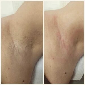 Трахается после эпиляции Ташкент