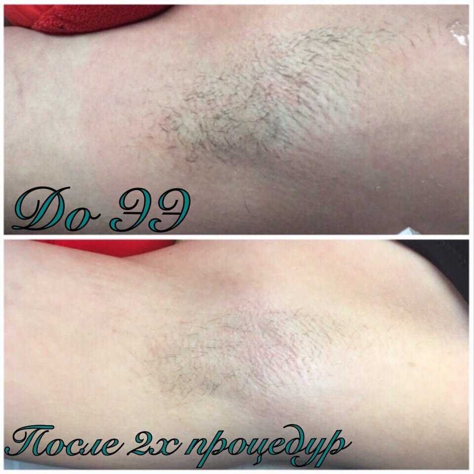 Средняя стоимость процедур в Ташкенте