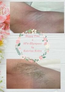 Услуги шугаринга на дому Ташкент