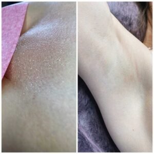 Восковая депиляция подмышек Ташкент